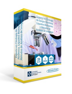 Imagen de la Obra: Experto Universitario en Citología de Sangre Periférica, Líquidos Biológicos y Métodos de Análisis de Imágenes Experto Universitario en Citología de Sangre Periférica, Líquidos Biológicos y Métodos de Análisis de Imágenes