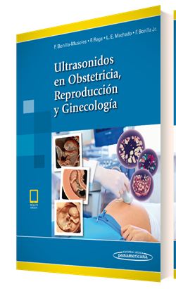 Imagen del Libro: Ultrasonidos en Obstetricia, Reproducción y Ginecología (incluye versión digital) Ultrasonidos en Obstetricia, Reproducción y Ginecología (incluye versión digital)
