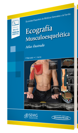Imagen del Libro: Ecografía Musculoesquelética (incluye versión digital) Ecografía Musculoesquelética (incluye versión digital)