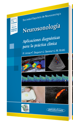 Imagen del Libro: Neurosonología (incluye versión digital) Neurosonología (incluye versión digital)