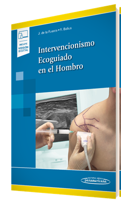 Imagen del Libro: Intervencionismo Ecoguiado en el Hombro (incluye versión digital) Intervencionismo Ecoguiado en el Hombro (incluye versión digital)