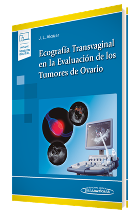 Imagen del Libro: Ecografía Transvaginal en la Evaluación de los Tumores de Ovario (incluye versión digital) Ecografía Transvaginal en la Evaluación de los Tumores de Ovario (incluye versión digital)