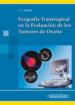 Imagen del Libro: Ecografía Transvaginal en la Evaluación de los Tumores de Ovario Ecografía Transvaginal en la Evaluación de los Tumores de Ovario