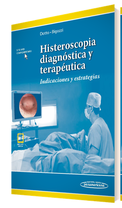 Histeroscopia Diagnostica Y Terapeutica Incluye Version Digital