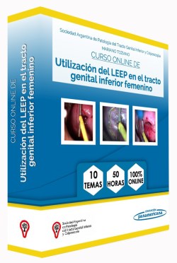 Imagen de la Obra: Curso Online de utilización del LEEP en el tracto genital inferior femenino Curso Online de utilización del LEEP en el tracto genital inferior femenino