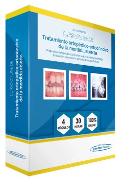 Imagen de la Obra: Curso Online de Tratamiento ortopédico-ortodóncico de la mordida abierta Curso Online de Tratamiento ortopédico-ortodóncico de la mordida abierta