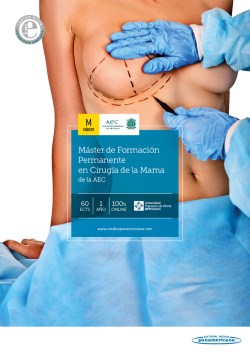 Imagen de la Obra: Máster en Cirugía de la Mama de la AEC Máster en Cirugía de la Mama de la AEC
