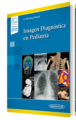 Imagen del Libro: Imagen Diagnóstica en Pediatría (incluye versión digital) Imagen Diagnóstica en Pediatría (incluye versión digital)