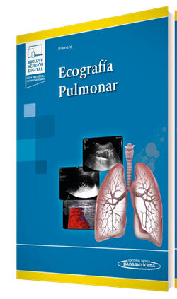 Ecografía Pulmonar