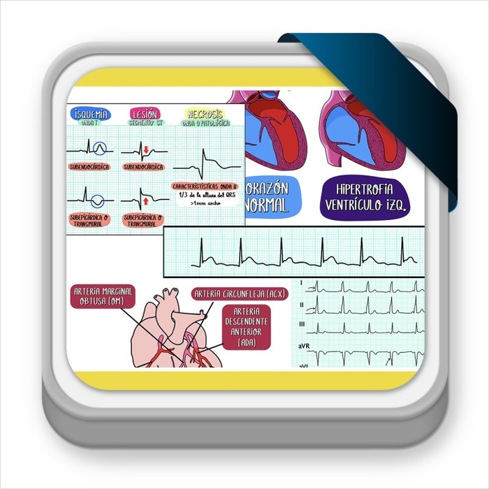 interpretación del electrocardiograma